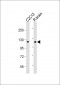 HK1 (Hexokinase) Antibody (N-term)